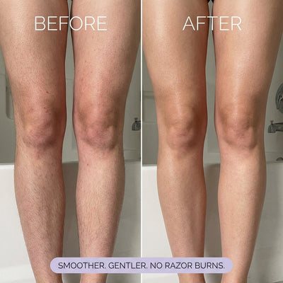 Koas Hair Removal Mousse VELORA