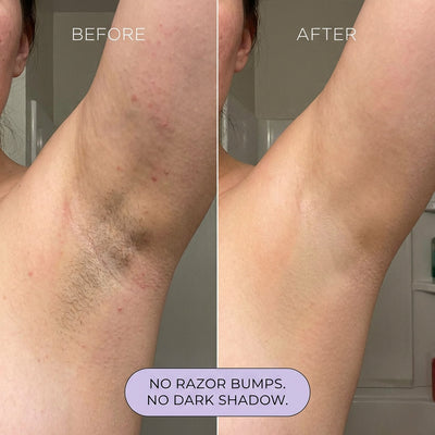 Koas Hair Removal Mousse VELORA