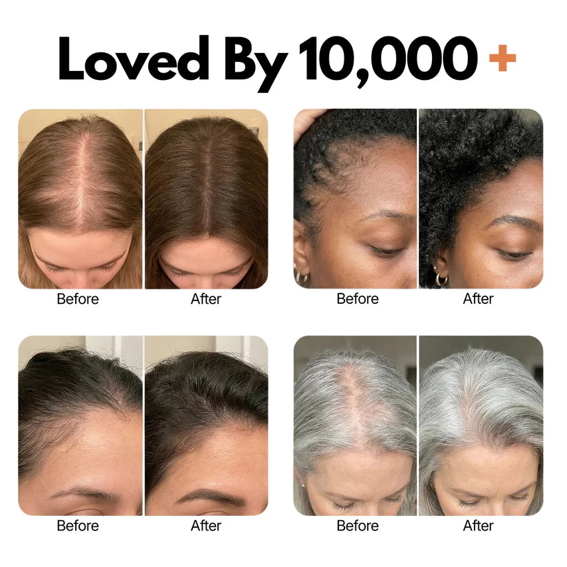 Stop Hair Loss. Start Growing. Korea's #1 Serum VHELORA