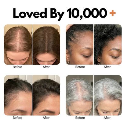 Stop Hair Loss. Start Growing. Korea's #1 Serum VHELORA