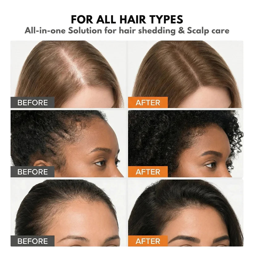 Stop Hair Loss. Start Growing. Korea's #1 Serum VHELORA