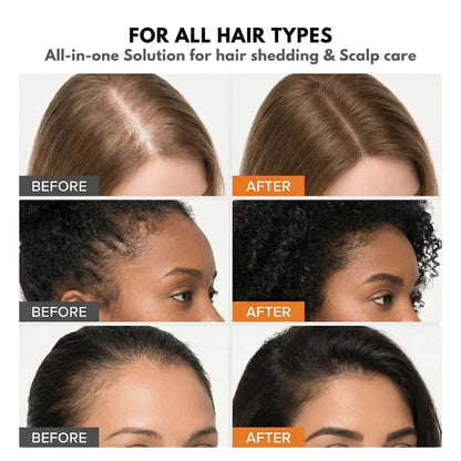 Stop Hair Loss. Start Growing. Korea's #1 Serum VHELORA